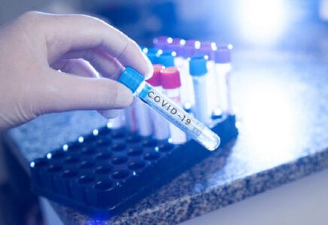 ESPÍRITO SANTO DO PINHAL REGISTRA CERCA DE 75% DE PACIENTES CURADOS DA COVID-19