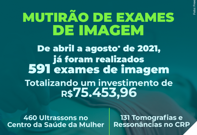 SECRETARIA DA SAÚDE REALIZA 591 EXAMES DE IMAGEM ATÉ O MOMENTO